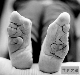 ​中国封建社会的残忍摧残，妇女极其痛苦