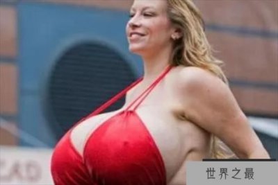 ​吉尼斯最大胸纪录保持者 斯蒂斯(两个胸重77斤)