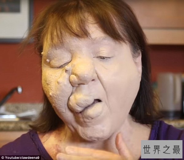世界上最恶心的人,又丑又恶心的男人女人(慎入)