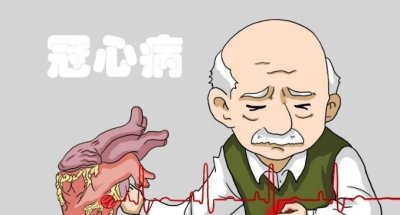​头顶脱发的人冠心病风险高吗 哪些征兆警惕冠心病