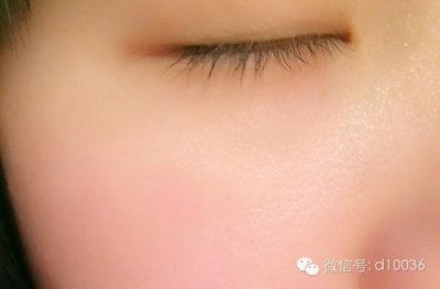 ​像素激光去痘印多少钱 激光去痘坑心得分享