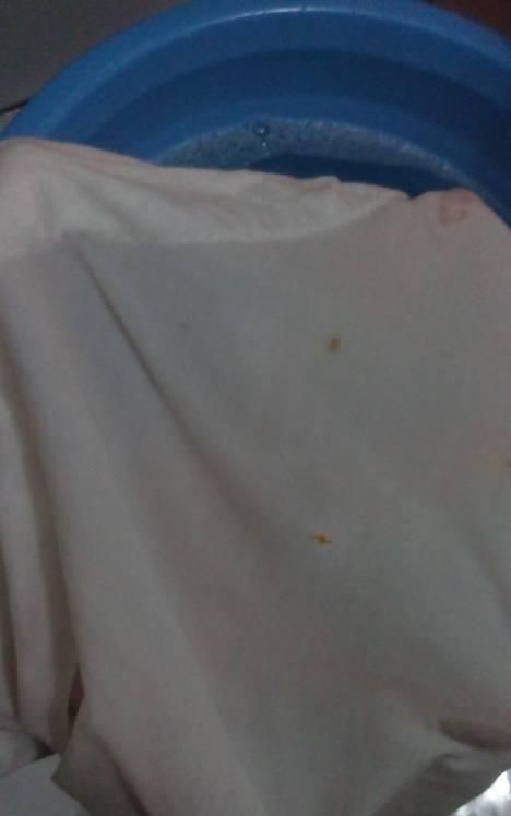 衣服上有黄渍如何清洗,衣服上发黄的污渍怎么去除小妙招