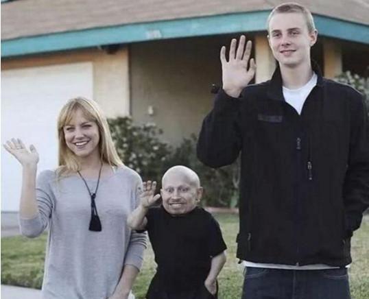 全球最矮81厘米男星去世,生前女友都是美女,有酗酒自杀迹象