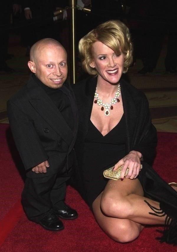 全球最矮81厘米男星去世,生前女友都是美女,有酗酒自杀迹象