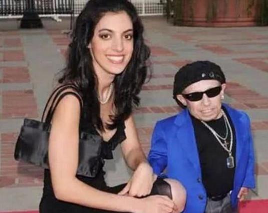 全球最矮81厘米男星去世,生前女友都是美女,有酗酒自杀迹象