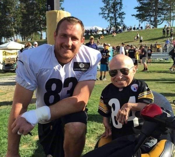 全球最矮81厘米男星去世,生前女友都是美女,有酗酒自杀迹象