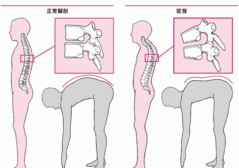 罗锅是什么美食,罗锅是什么意思图8