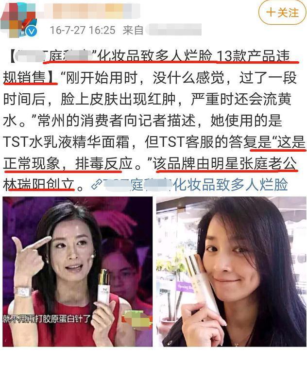 带女卖货？张庭女儿10岁就用自家面膜，客服却说未成年不能用？