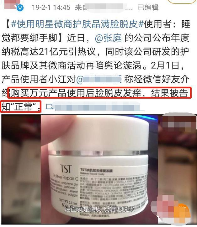带女卖货？张庭女儿10岁就用自家面膜，客服却说未成年不能用？