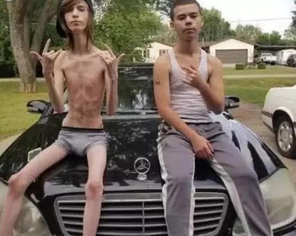 世界上最瘦的男子，他却觉得没什么不对，并因此成网红